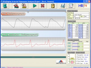 DPA Cardio Analysis